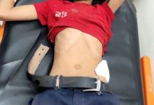 صورة مقتل وجرح طفلين برصاص قناص حوثي في تعز