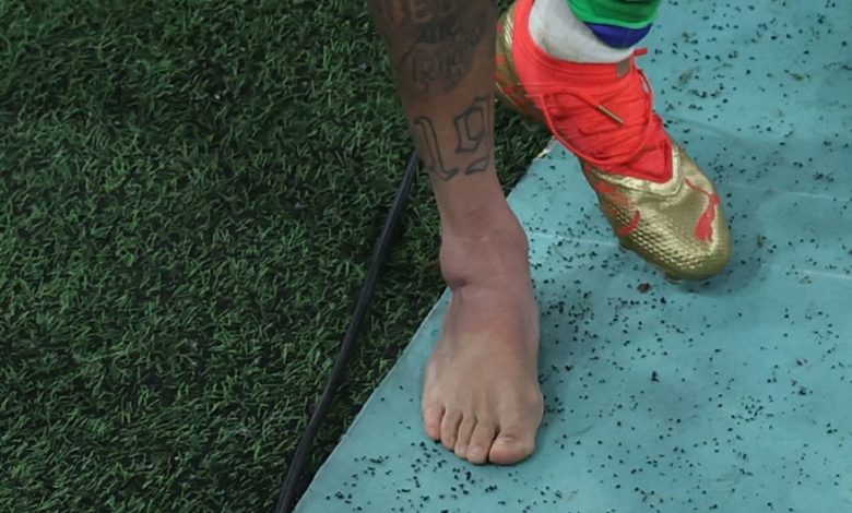 صورة طبيب منتخب البرازيل يكشف طبيعة إصابة نيمار ومدة غيابه