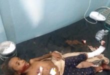 صورة إصابة مسنّة وطفلتين في انفجار لغم حوثي في الحديدة