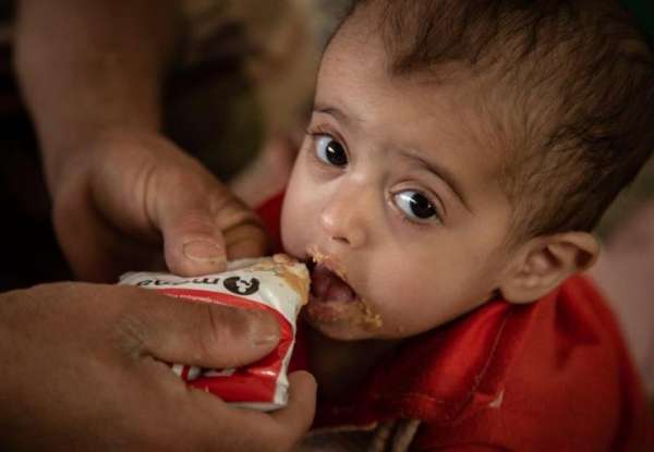 صورة “منظمة دولية” : انخفاض الدعم الإنساني لليمن بنسبة 62% يعرض الملايين للخطر