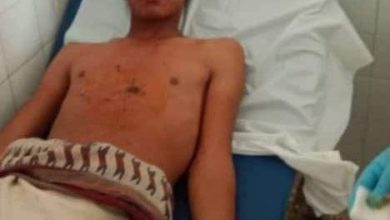 صورة إصابة مواطن إثر انفجار مقذوف حوثي في البيضاء 