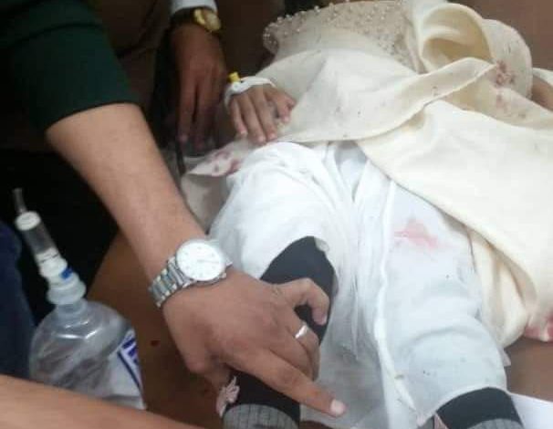 صورة إصابة طفلة وشقيقها برصاص قناصة مليشيا الحوثي في تعز