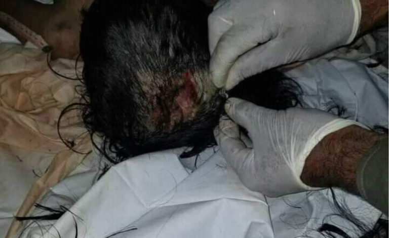 صورة الزوجة تعذب الطفلة حتى الموت والأب يتولى عملية الدفن  لإخفاء الجريمه (صورة)