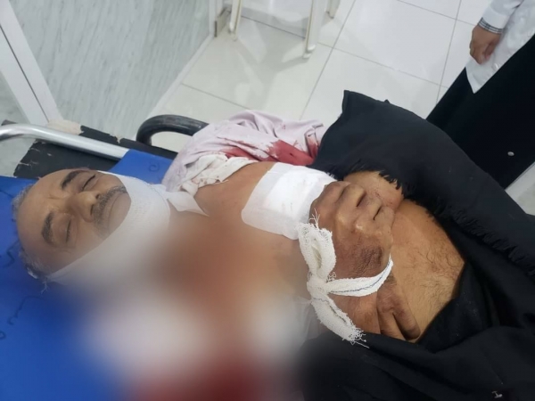مقتل وإصابة أكثر من 28 ألف مدنيا بالعدوان الحوثي منذ بداية الانقلاب