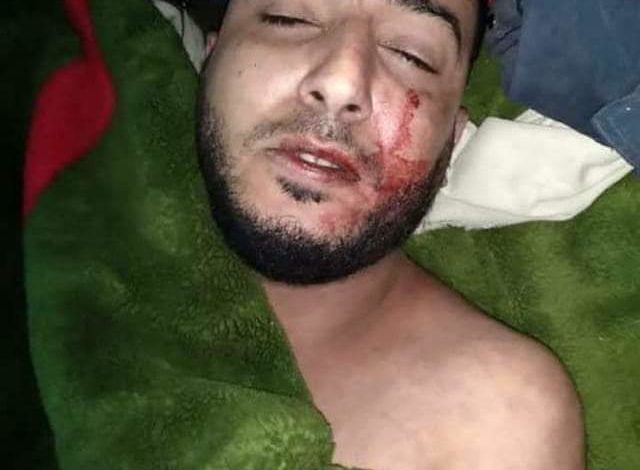 صورة ادانات واسعة لمقتل شاب يمني قدم من أمريكا جنوب اليمن ومطالبات بمحاكمة القتلة