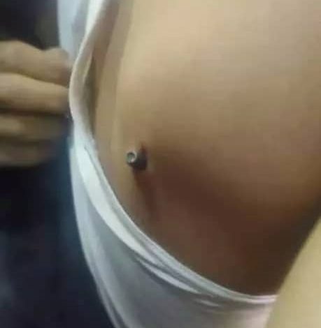 صورة عاجل: سقوط عشرات الضحايا في اليمن جراء احتفالات الفوز ببطولة غرب آسيا “صورة”