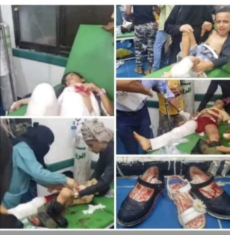 صورة «مجزرة الحوثيين» بحق أطفال تعز تثير غضب الحقوقيين والأحزاب اليمنية