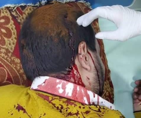 تفاصيل جديدة حول الإعتداء على رجل الأعمال الكبوس وأولاده بصنعاء.. “صورة”