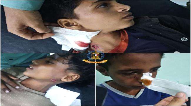 صورة انفجار مقذوف حوثي في 3 أطفال شمال الضالع