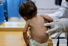 صورة الأمراض المُعدية تنهش شمال اليمن والمليشيات تواصل تدمير المنظومة الصحية (تفاصيل)