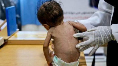 صورة الأمراض المُعدية تنهش شمال اليمن والمليشيات تواصل تدمير المنظومة الصحية (تفاصيل)