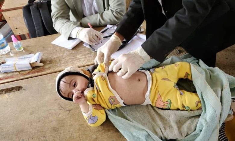 صورة الحصبة تفتك بأطفال اليمن: 259 وفاة و26 ألف إصابة خلال 6 أشهر