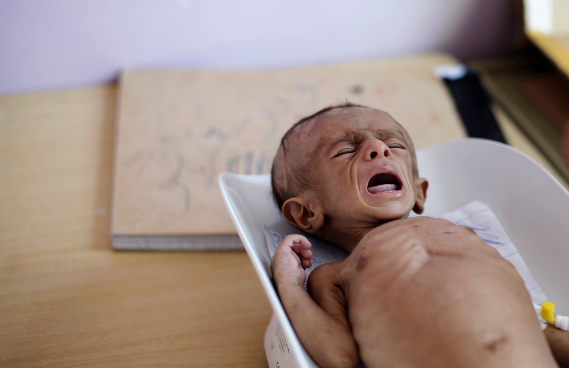 تحذير من دخول اليمن في مجاعة بسبب استمرار الصراع