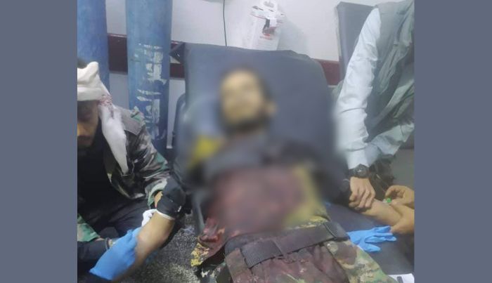صورة اغتيال جندي برصاص مجهولين في محافظة الضالع