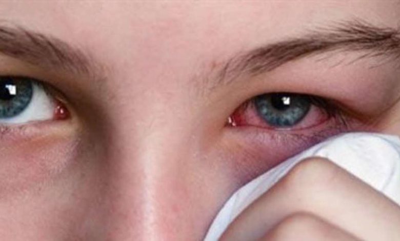 صورة الرمد يواصل اجتياح عدن