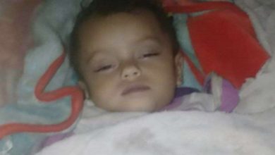 صورة وفاة طفلة غرقاً داخل وعاء طلاء بمحافظة تعز