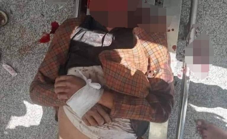 صورة اقتحام اللواء 170 و مقتل صهيب المخلافي في تعز