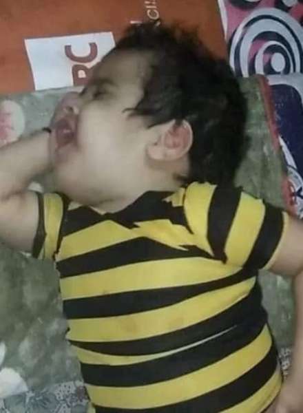 ارتفاع حالات الوفاة بين الأطفال بداء الحصبة الألمانية بعد منع الحوثيين للقاحات الطبية بحجة