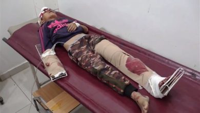 صورة إصابة طفل بشظايا قذيفة حوثية جنوبي تعز