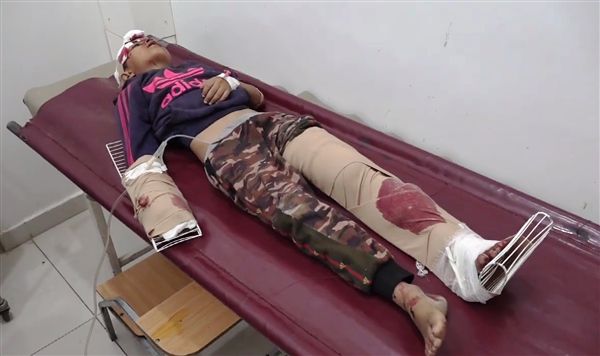 صورة إصابة طفل بشظايا قذيفة حوثية جنوبي تعز