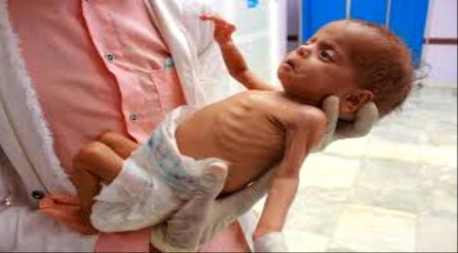 صورة الصحة العالمية :النظام الصحي في اليمن هش ويقترب من الانهيار