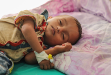 صورة وفاة طفل يمني كل 13 دقيقة بسبب أمراض يمكن علاجها او الوقاية منها