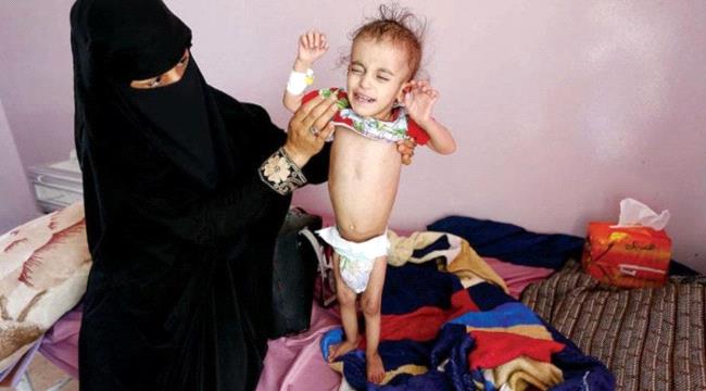 صورة اليونيسف محذرة: 6 ملايين طفل يمني على بعد خطوة واحدة من المجاعة