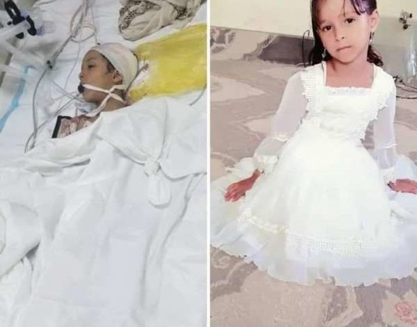 صورة وفاة طفلة في تعز إثر إصابتها برصاص راجع