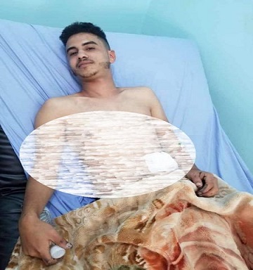 صورة إصابة شاب وامرأتين في حادثتي سطو مسلح وعنف أسري في إب