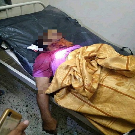 صورة شاب يقتل والد زوجته في كرش لحج