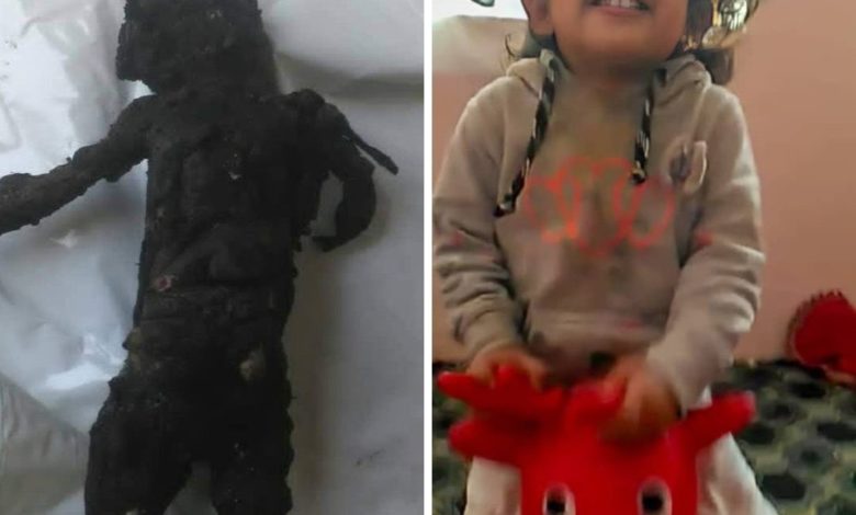 صورة ليان طاهر.. قصة طفلة قتلها الحوثي مع والدها وأرداها جثة متفحمة