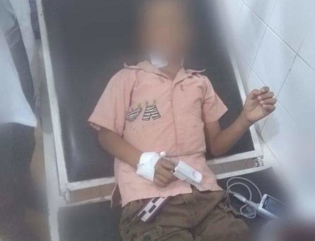 صورة معلمة يمنية توجه عدة طعنات بسكين لطفل بالصف الأول ابتدائي وحاولت ذبحه داخل الفصل