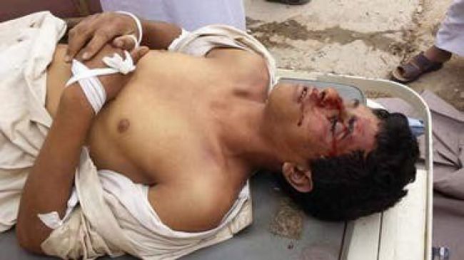 صورة ضربوه بأعقاب البنادق.. مقتل شاب على أيدي قيادي حوثي في صعدة
